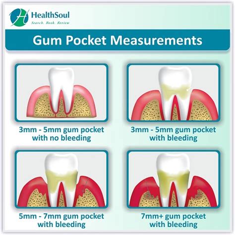 Can gum measurements improve?