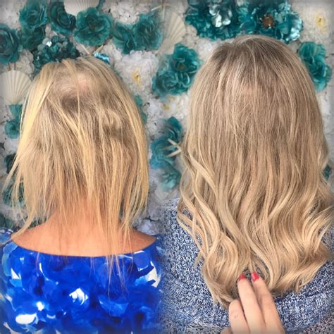 Can hair extensions help with thinning hair?