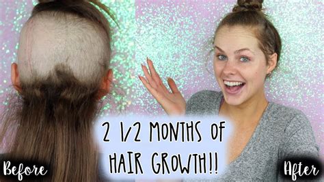 Can hair grow 2 inches in 2 months?