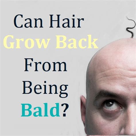 Can hair grow back after balding?
