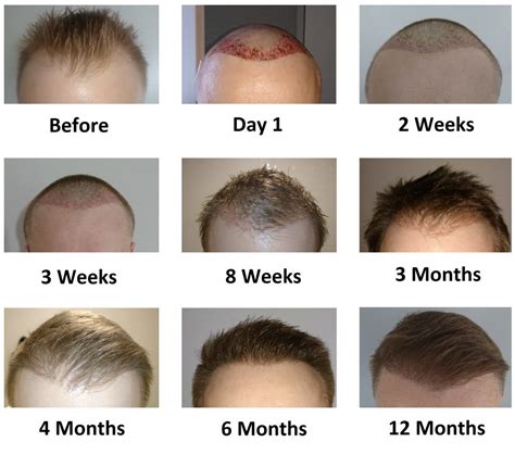 Can hair grow in 4 weeks?