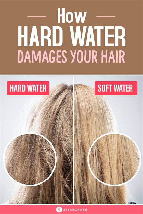 Can hard water cause hair loss?