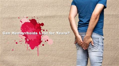 Can hemorrhoids last a lifetime?