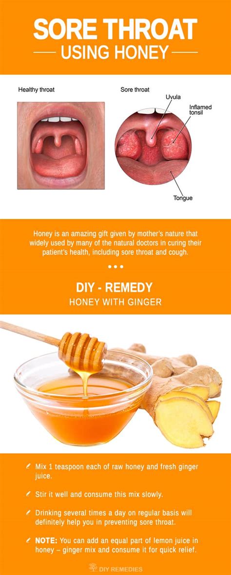Can honey treat cold sores?