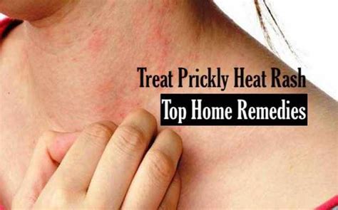 Can hot water cause a rash?