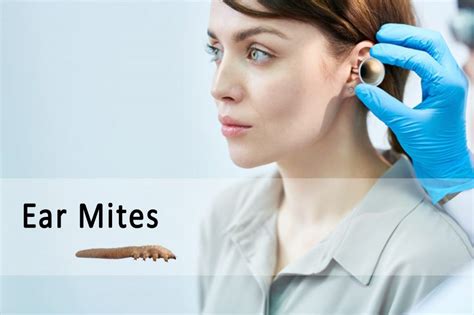 Can humans be infected with ear mites?