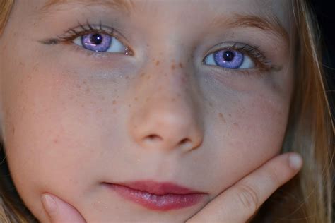 Can humans have violet eyes?