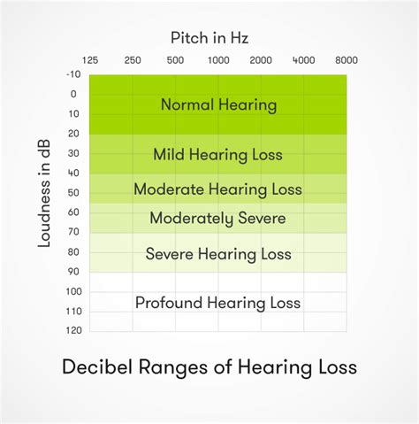 Can humans hear 10 dB?
