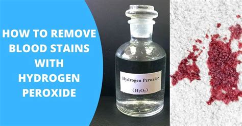 Can hydrogen peroxide remove ink stains?