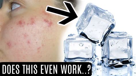 Can ice damage my skin?