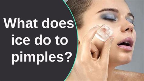 Can ice make a pimple go away?