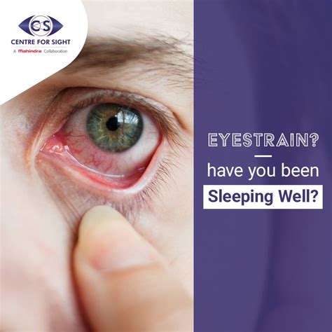 Can lack of sleep cause bulging eyes?