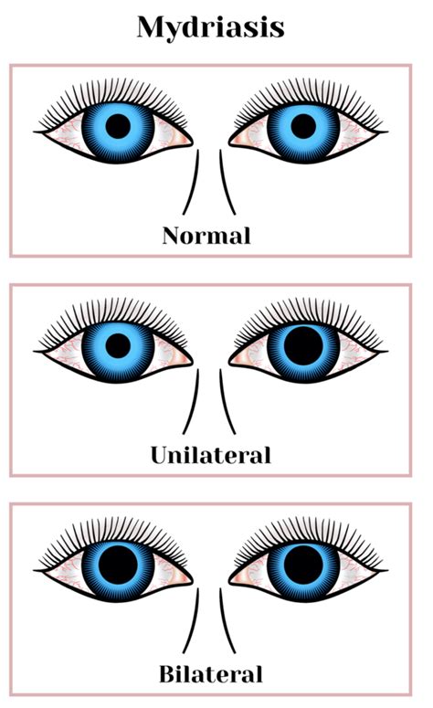 Can lack of sleep dilate pupils?