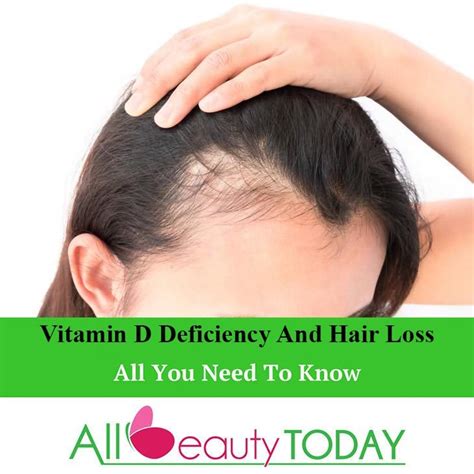 Can lack of vitamin D cause hair loss?