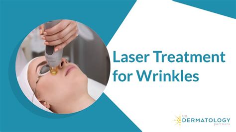 Can laser fix deep wrinkles?