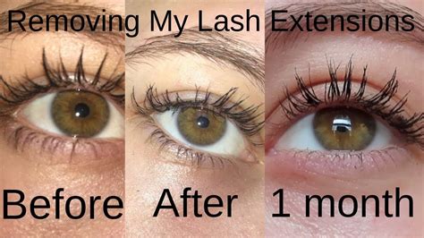 Can lash extensions damage your eyesight?