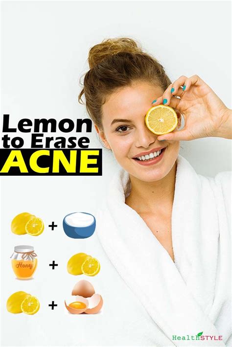 Can lemon clear pimples?