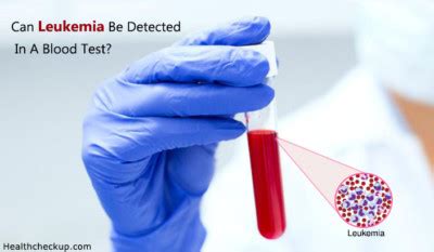 Can leukemia be caught in a blood test?