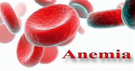 Can leukemia be mistaken for anemia?