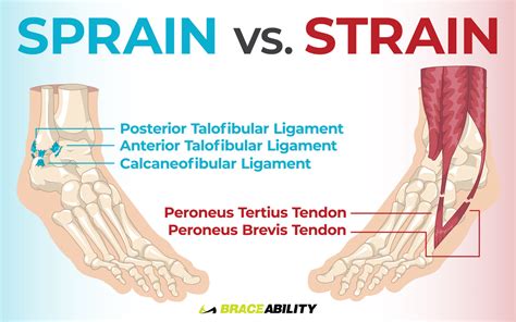 Can ligaments be permanently stretched?