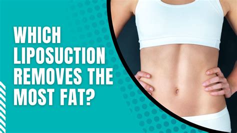 Can lipo remove visceral fat?