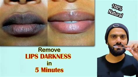 Can lips turn black after applying honey?