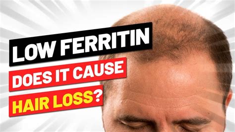 Can low ferritin cause hair loss?