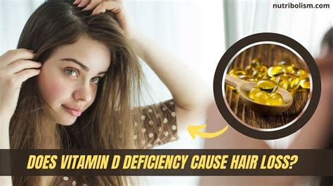 Can low vitamin D cause hair loss?