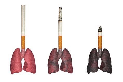 Can lungs heal after 40 years of smoking?