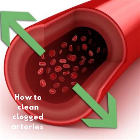 Can magnesium clear arteries?