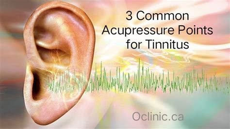 Can magnets stop tinnitus?