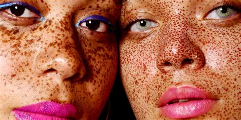 Can melanin return to skin?