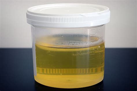 Can mercury be detected in urine?