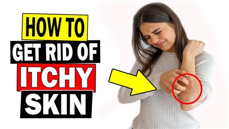 Can mercury make you itchy?