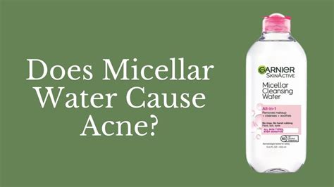 Can micellar water give you acne?