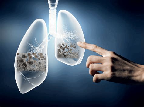 Can mold scar your lungs?