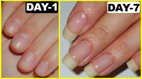 Can nails grow in 10 days?