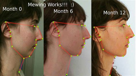 Can nose breathing change your face shape?