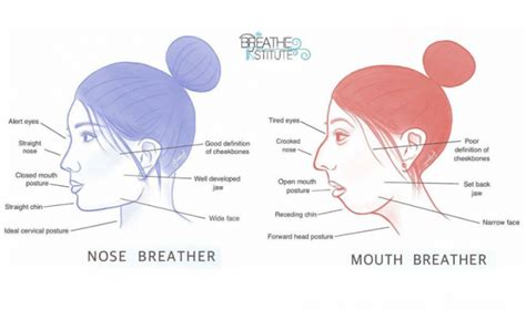 Can nose breathing fix long face syndrome?