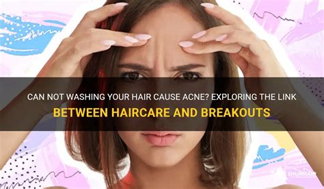 Can not washing hair cause acne?