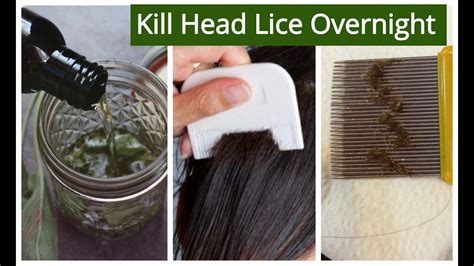 Can oil kill lice eggs?