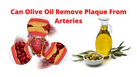 Can olive oil remove plaque from arteries?