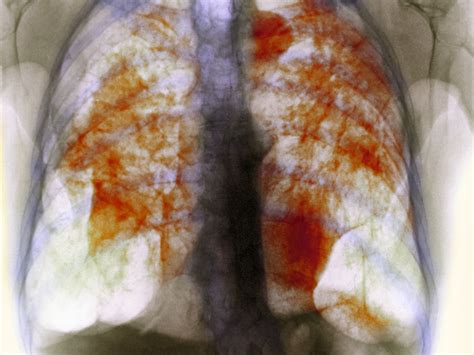 Can paint damage your lungs?