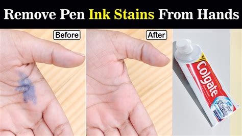 Can pen ink stain permanent on skin?