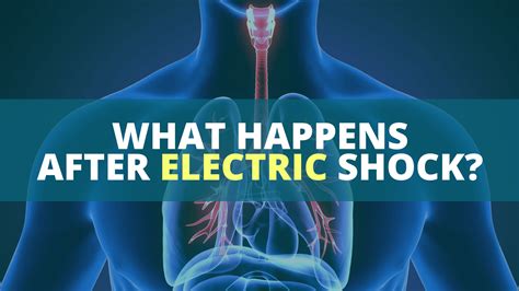 Can people survive electric shock?