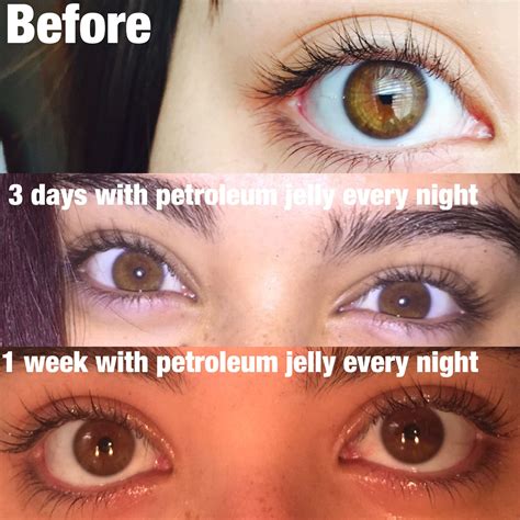 Can petroleum jelly grow eyelashes?