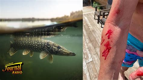 Can pike bite people?