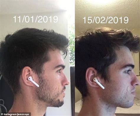 Can posture change your face?