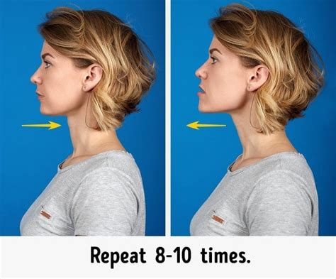 Can posture fix double chin?