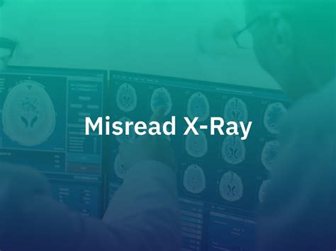 Can radiologist misread MRI?